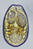 Prorocentrum foraminosum