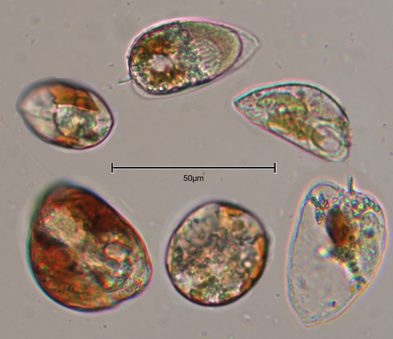 Prorocentrum micans